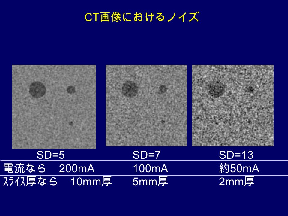 SD=5 電流なら 200mA ｽﾗｲｽ厚なら 10mm 厚 SD=7 100mA 5mm 厚 SD=13 約 50mA 2mm 厚 CT 画像におけるノイズ