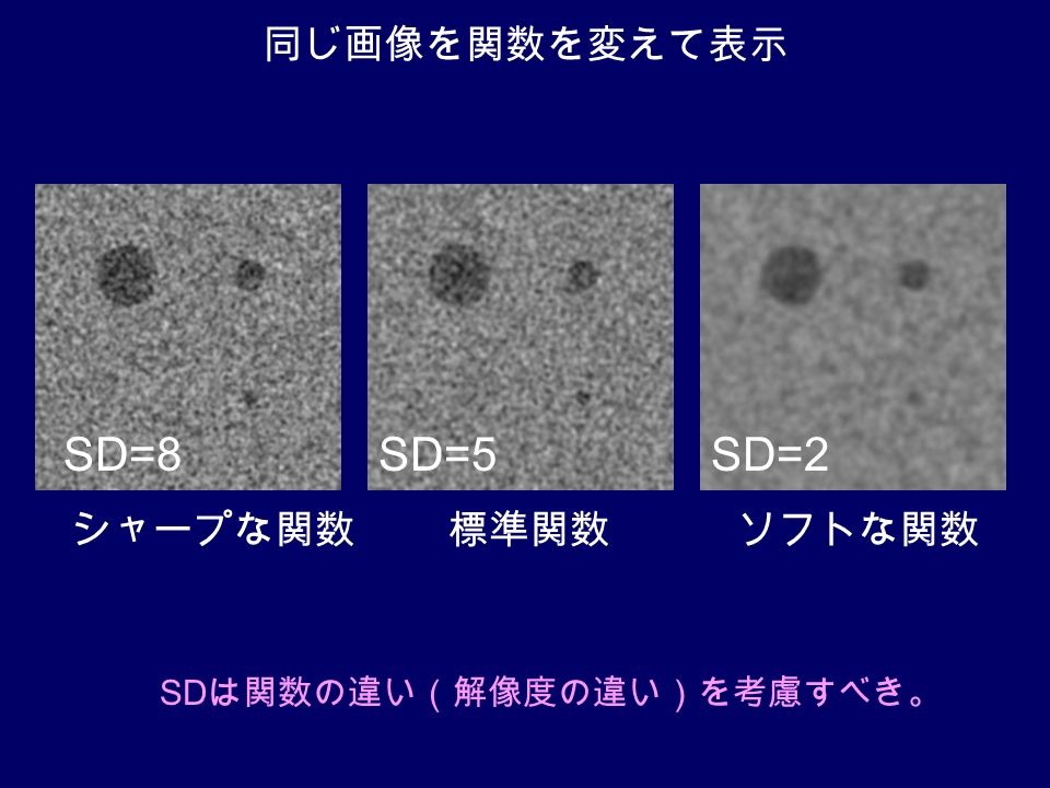 標準関数シャープな関数ソフトな関数 SD は関数の違い（解像度の違い）を考慮すべき。 同じ画像を関数を変えて表示 SD=5SD=2SD=8