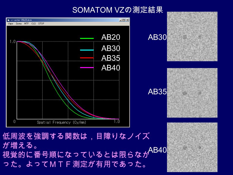 AB20 AB30 AB35 AB40 SOMATOM VZ の測定結果 AB30 AB35 AB40 低周波を強調する関数は，目障りなノイズ が増える。 視覚的に番号順になっているとは限らなか った。よってＭＴＦ測定が有用であった。