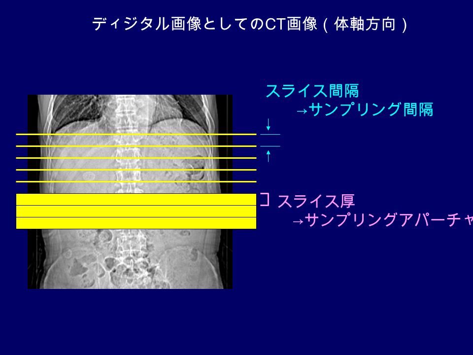 ディジタル画像としての CT 画像（体軸方向） スライス厚 → サンプリングアパーチャ スライス間隔 → サンプリング間隔