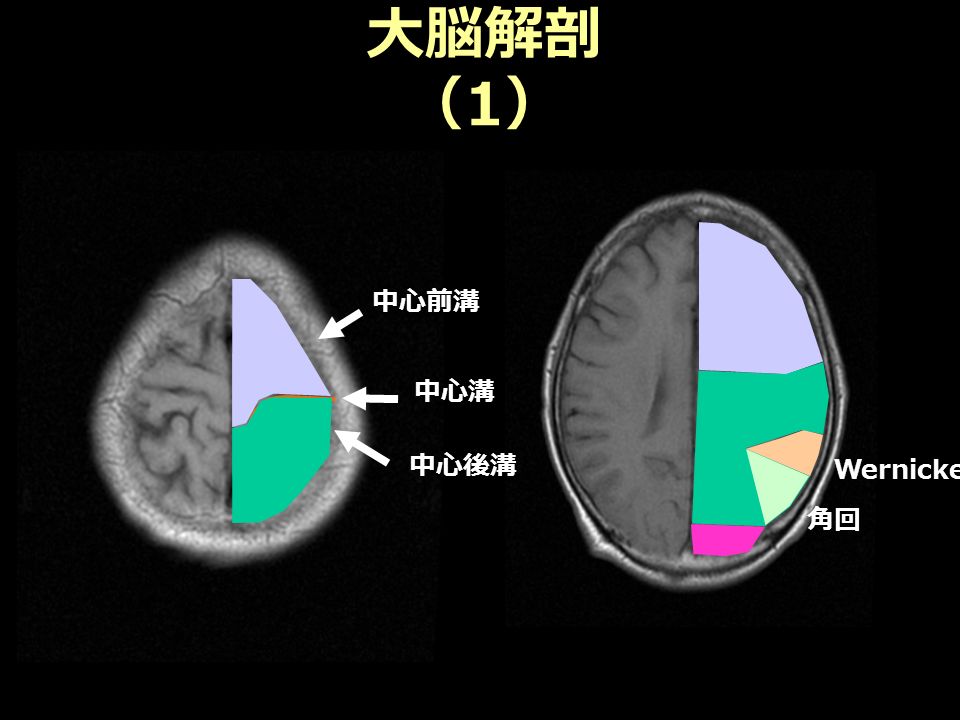 大脳解剖 （ 1 ） 中心前溝 中心溝 角回 Wernicke 野 中心後溝